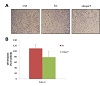 Hsp27 Expression Does Not Affect Anti-Cancer Drug Sensitivity but Promote Cell Proliferation of Lung Squamous Cell Carcinoma In Vitro