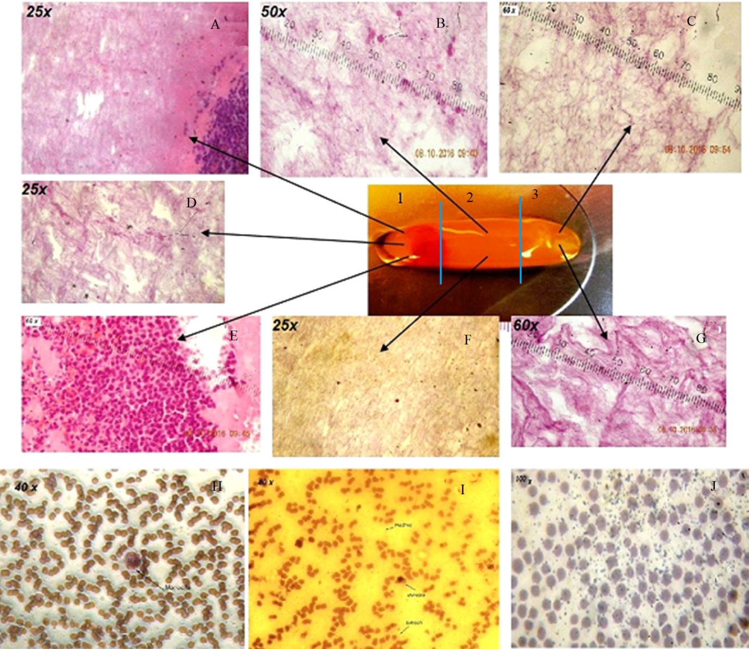 The L-PRF Membrane (Fibrin Rich in Platelets and Leukocytes) And Its Derivatives Useful as A Source of Stem Cells in Wound Surgery