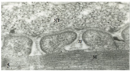 Shigeru Tsuji  (1936-2008): A Master in the Histochemistry of the Cholinergic Synapse – Insight for Future Researches