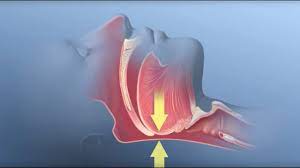 Effect of Nasal Continuous Positive Airway Pressure on Plasma Asprosin, Chemerin and ANGPTL4 Levels in Patients with Obstructive Sleep Apnea