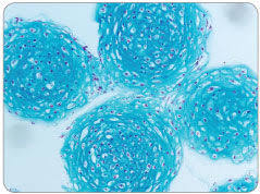 Preliminary Study on the Expression of PI3K/ AKT/mTOR Signal Pathway During the Chondrogenesis of hMSCs